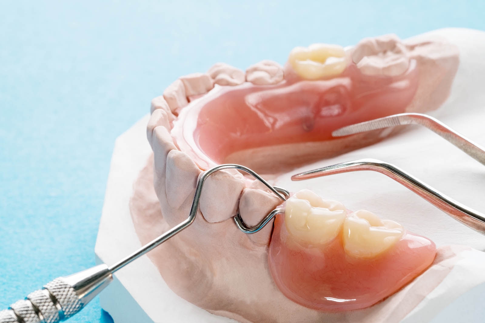 partial denture dentist north brisbane