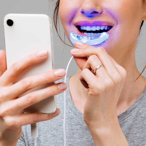 DIY Teeth Whitening: A Risk Worth Taking?