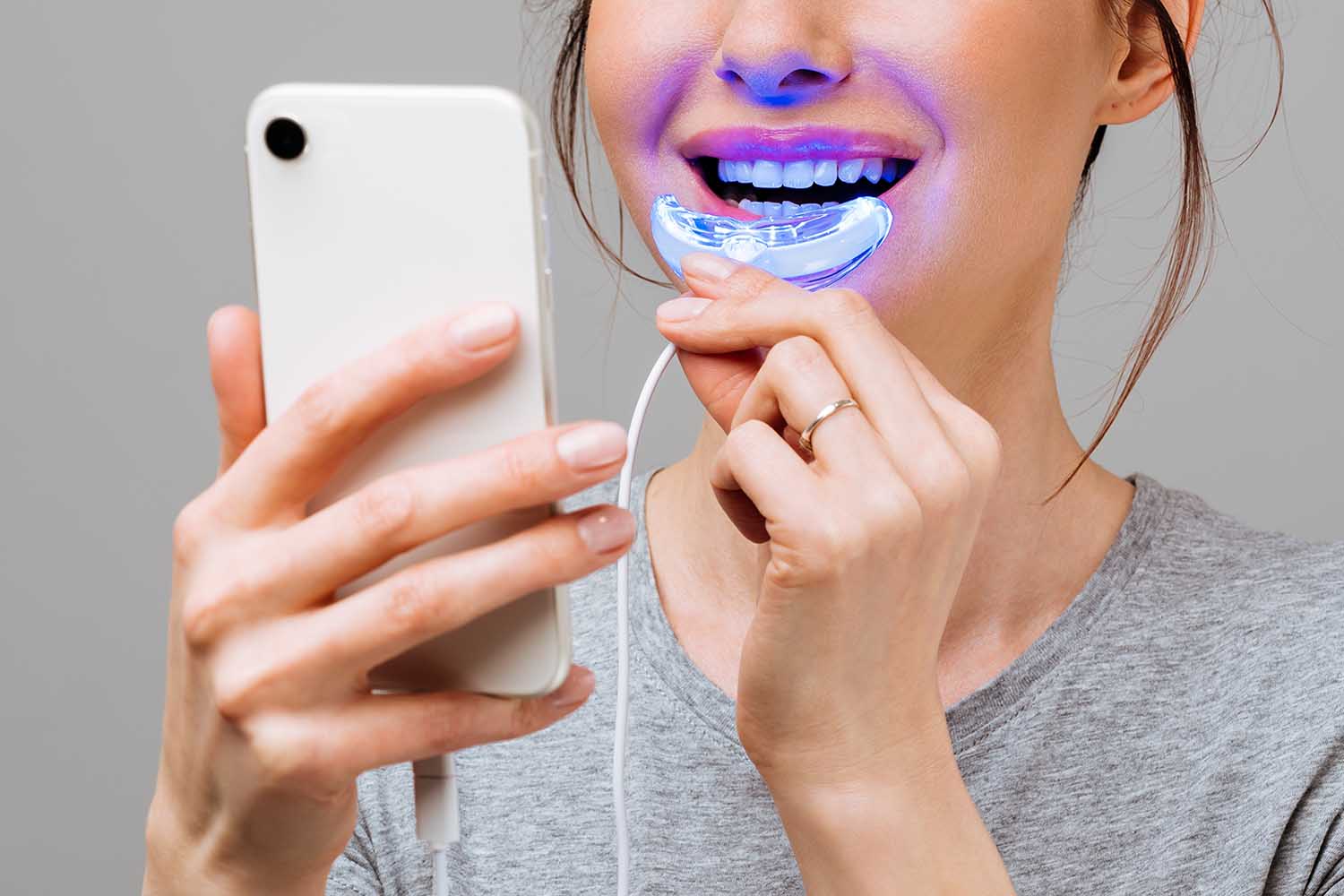 DIY Teeth Whitening A Risk Worth Taking? Smile Time Family Dental